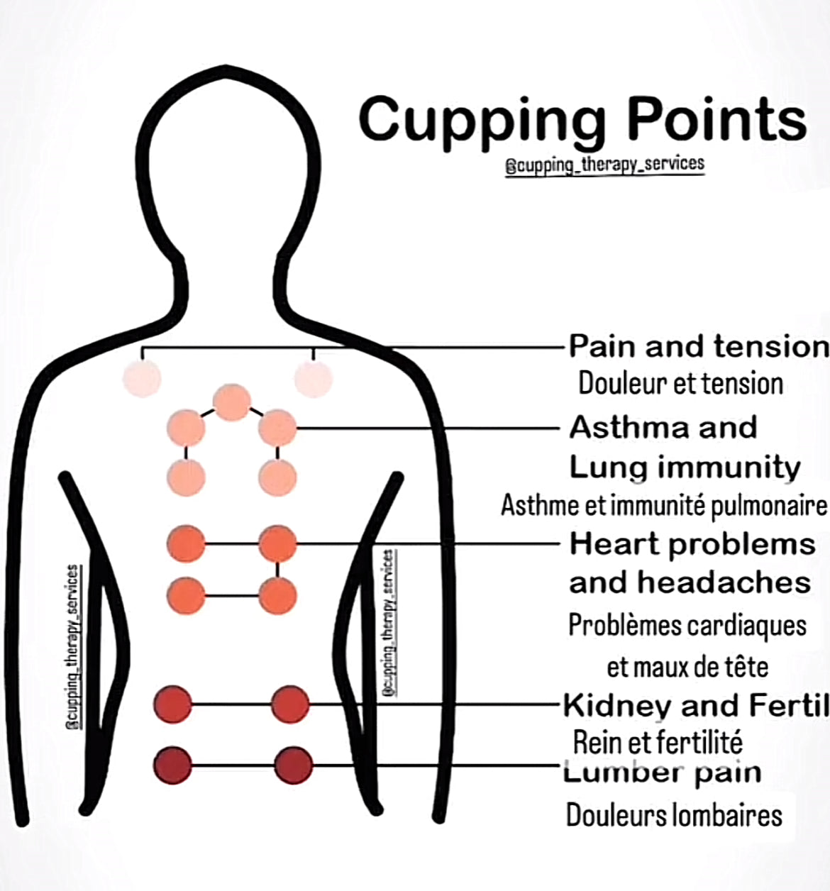 Vacuum Cupping Massage Anti Cellulite Magnet Therapy